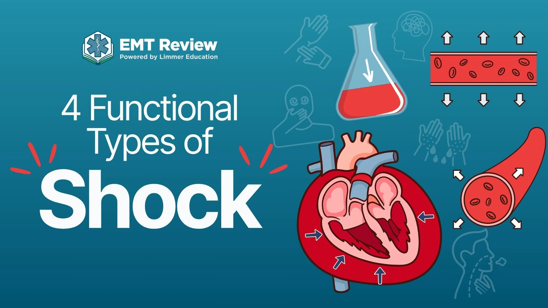 Four Types of Shock Thumbnail